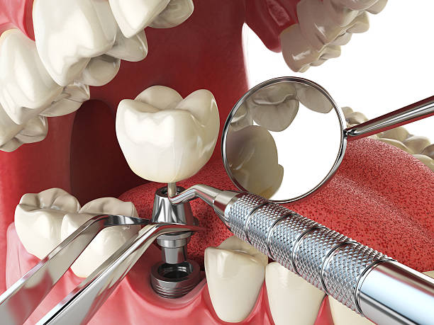 Best Emergency Denture Repair in Paramount Long Meadow, MD